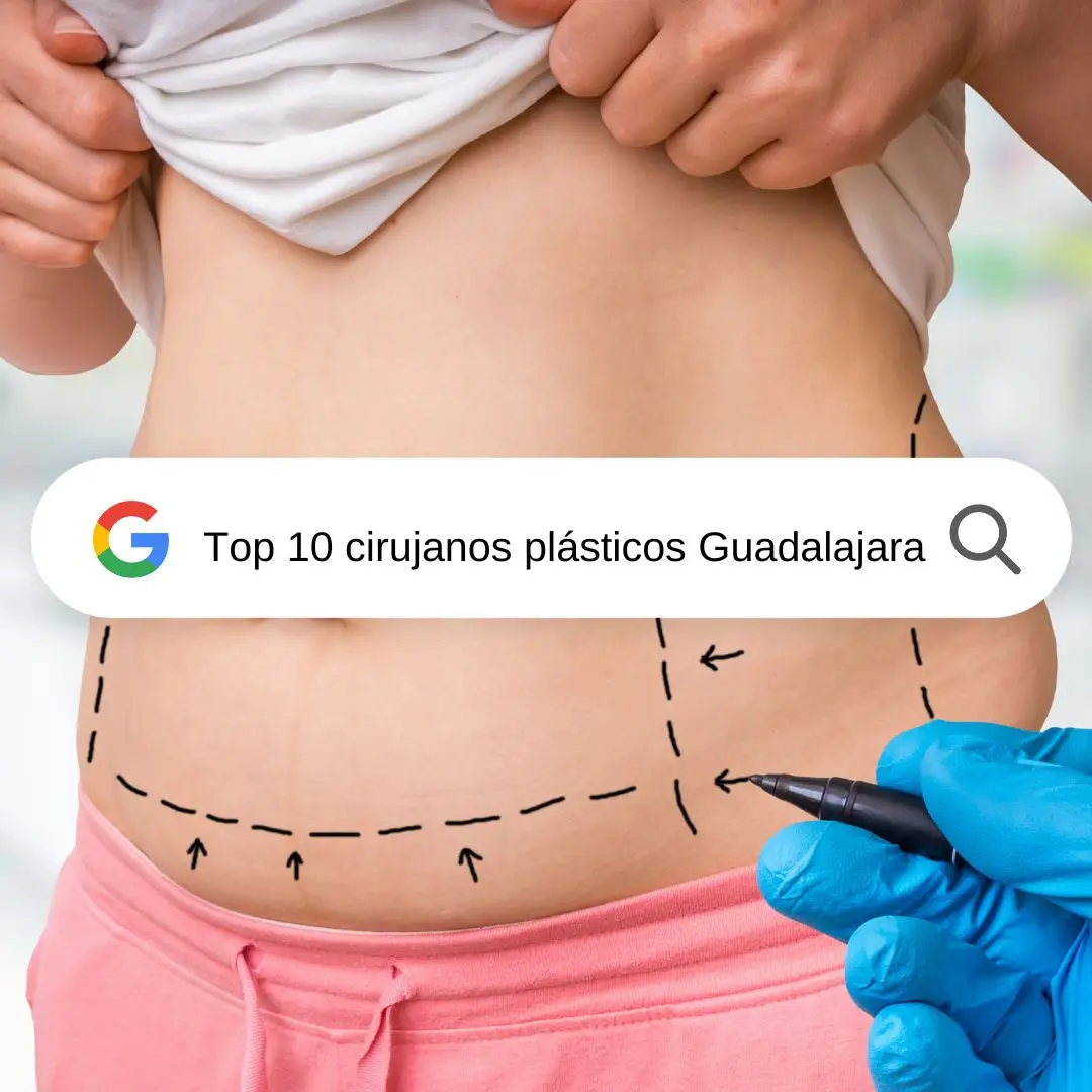 Top 10 Cirujanos Plasticos en Guadalajara
